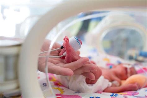 Perawatan Bayi Prematur Yang Tepat Dilakukan Simak Ini Moms Good