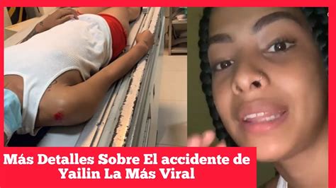 mÁs detalles sobre el lamentable accidente de la artista y bailarina urbana yailin la mÁs viral
