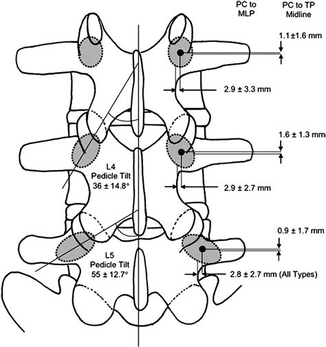 P An Anatomical Study Which Describes The Relationship Of The Pedicle Center To The Mid