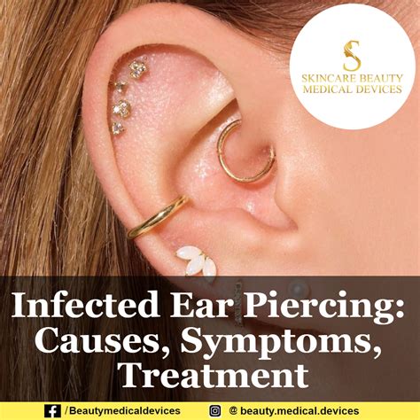 Infected Ear Piercing Causes Symptoms Treatment
