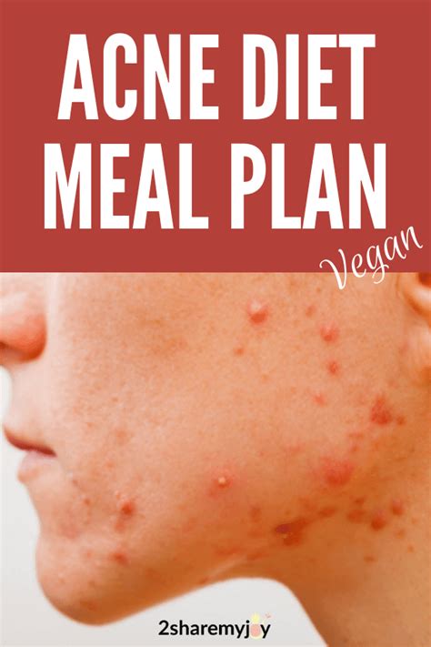 Hormonal Acne Diet Plan Best 7 Day Clear Skin Meal Plan Pdf Clear