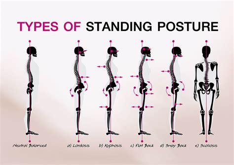 A Guide To Good Posture Macclesfield Strength And Conditioning