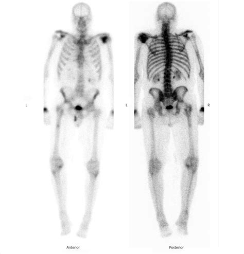 Part 8 Bone Radiology Key