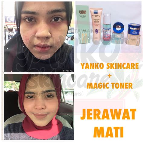 Depending on product type, the malaysia skin care products market is classified into cream, lotion, and others. YANKO SKINCARE MALAYSIA