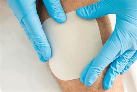 Hydrocolloid Wound Dressings Benefits And Applications Wound Care