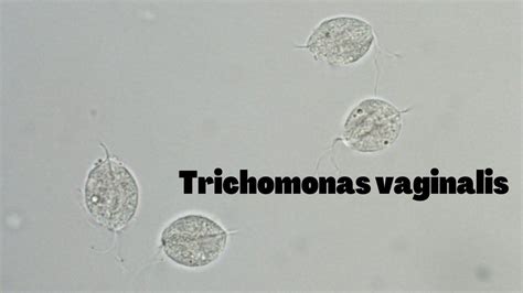 Trichomonas Vaginalis In Urine Microscopy At X Power Trichomonas