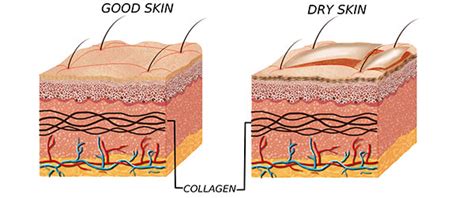 How To Prevent Dry Skin 6 Methods Which Gives Noticeable Results