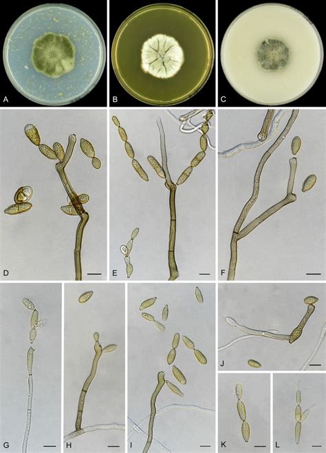 Cladosporium Species In Indoor Environments Biology Online Archive