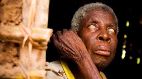 River blindness is caused by a parasitic worm that lives for up to 14 years inside the human body. River Blindness (onchocerciasis) Documentary - YouTube