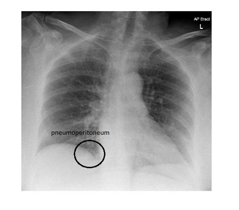 Imaging Case Of The Week 294 Answer Emergucate