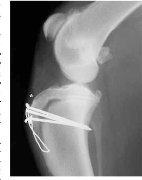 Figure 7 From Does Osgood Schlatter Disease Exist In The Dog