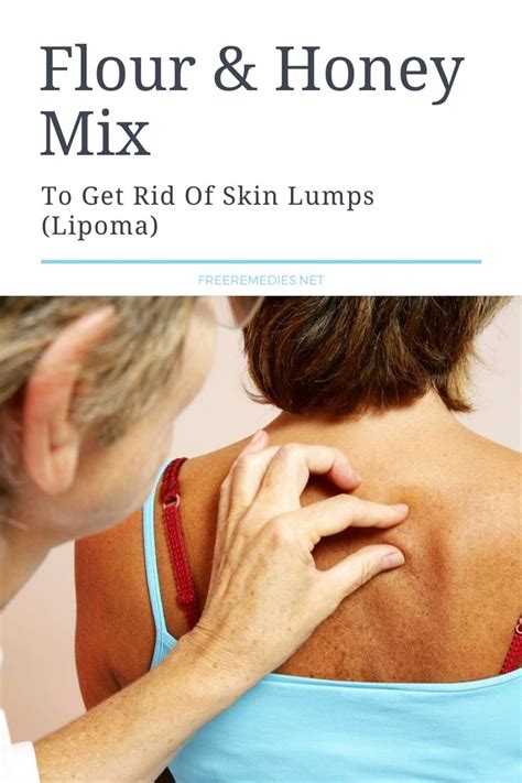 Pin On Lump Under Skin On Face