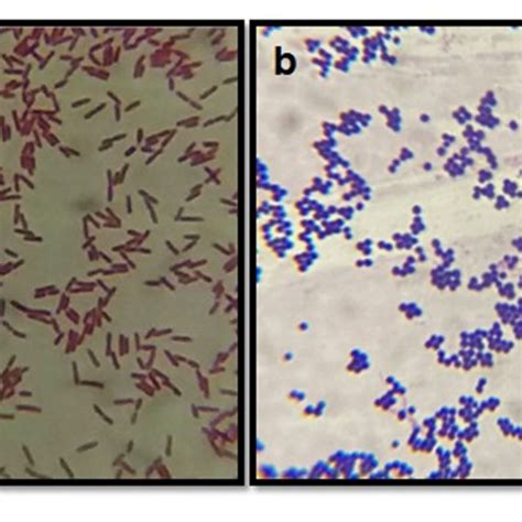 Grams Staining Of Bacterial Isolates A Depicts The Gram Negative