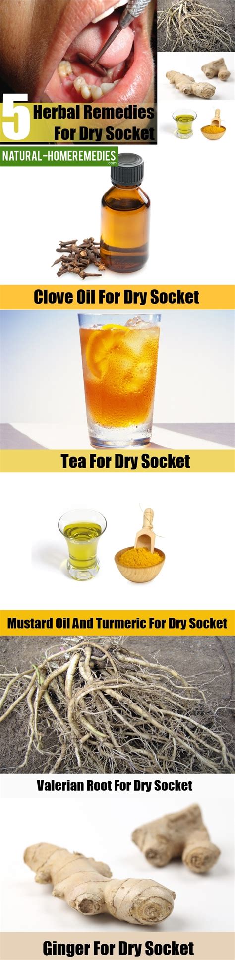 Dry Socket Herbal Remedies Treatments And Cures Natural Home