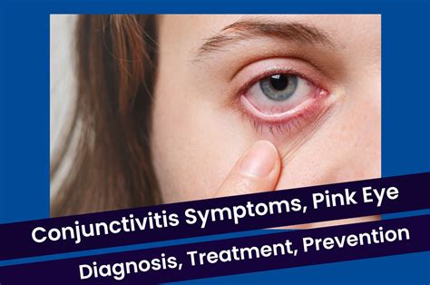 Conjunctivitis Symptoms Pink Eye Diagnosis Treatment Medicine And