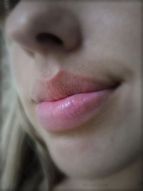 Canker Sore On Outer Lip Pictures Photos
