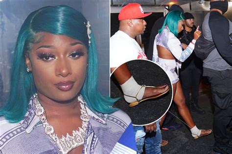 Megan Thee Stallion Shares Photos Of Stitches Removed After Shooting