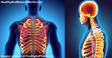 Back Rib Cage Muscles Sore To Touch Rib Cage Fibromyalgia Syndrome