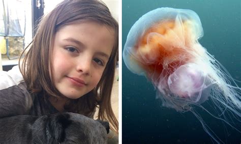 Warning After Sting From Huge Jellyfish Off Fife Coast Leaves Boy 9