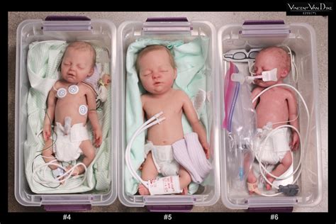 Preemies Vincent Van Dyke Effects