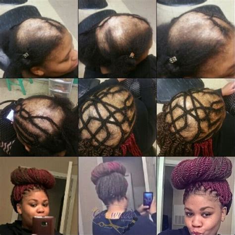 How To Braid Hair For Weave Sew In - 5 Best Braid Patterns for a Flawless Sew-in