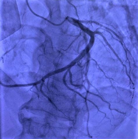 Cardiol Res