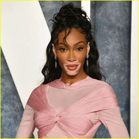 Winnie Harlow Reveals The Real Story Behind How She Came Up With Her