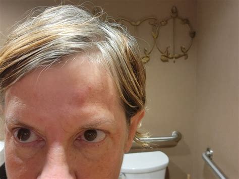 DERMATOLOGY SPECIALISTS OF ATLANTA - Updated August 2024 - 17 Photos