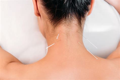 Dry Needling Treatment For Acute Chronic Muscular Conditions