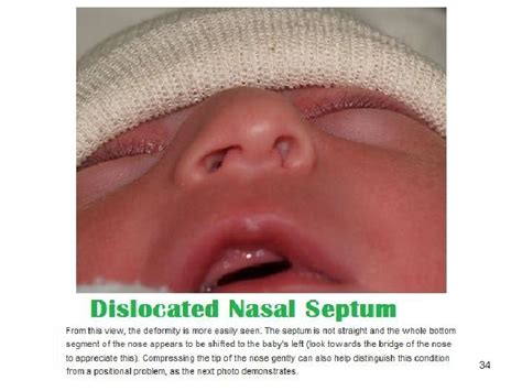 Physical Examination Of Newborn By Dr Behzad Barekatain