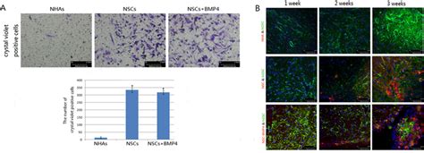 NSCs Migrate To HGSCs In Vitro And In Vivo A Upper Panel Transwell
