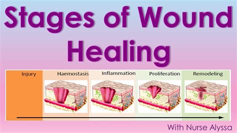 Stages Of Wound Healing Youtube