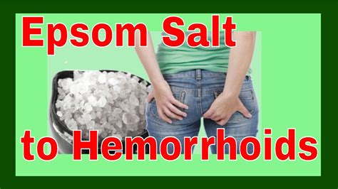 Hemorrhoids Treatment How To Use Epsom Salt To Relieve Hemorrhoids The Natural Cure