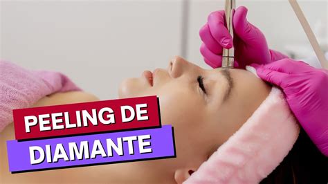 Peeling De Diamante Htm