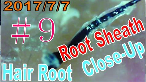 Hair Root Root Sheath Close Up ＃9【ingrown Hair Root And Root Sheath】 Youtube