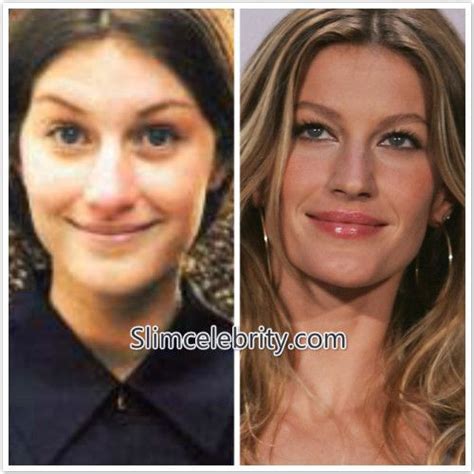 Pin On Gisele Bundchen Breast Implants And Nose Job Before And After Photos