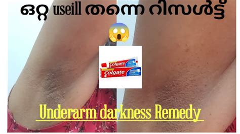 Say Yess To Sleeveless ️remedy For Underarm Darkness😱colgate Magic