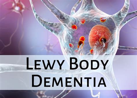 Lewy Body Dementia Complete Guide Readementia