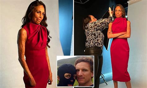 Inspirational Burns Survivor Turia Pitt Reveals How She Learned To Feel Attractive Again