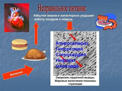 Какая Диета При Стенокардии — Похудение Диета Правильное Питание Картинка - Какая Диета При Стенокардии — Похудение Диета Правильное Питание