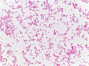 Gram Stain Of E Coli Showing Characteristic G Rods Bacterial