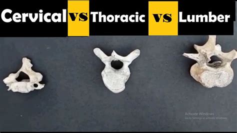 Cervical Thoracic And Lumbar Vertebrae