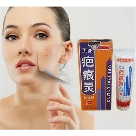 Jual Meilibahenling Cream Original Penghilang Bekas Cacar Koreng