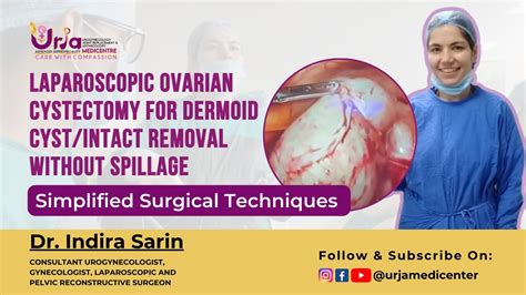 Laparoscopic Surgery For Ovarian Cysts Simplified Guide To Remove
