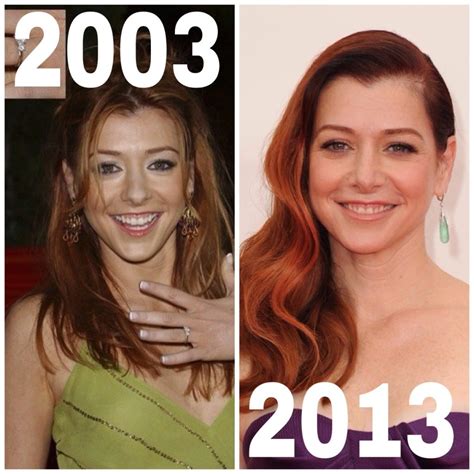 Alyson Hannigan Plastic Surgery Photo Before And After Celeb Surgerycom