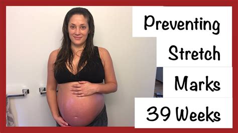 Preventing Stretch Marks While Pregnant Youtube