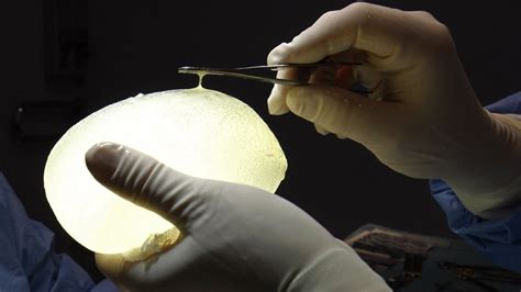 Pip Breast Implants French Court Tells Tuv To Pay Damages Bbc News
