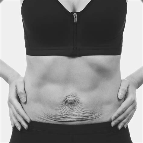 What You Should Watch Out For When Checking Diastasis Recti Bellyy