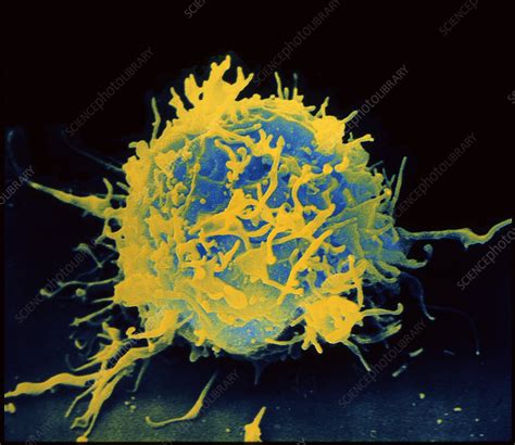 White Blood Cell Stock Image P2480112 Science Photo Library
