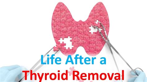 Life After A Thyroid Removal Thyroid Removal Thyroidectomy Thyroid
